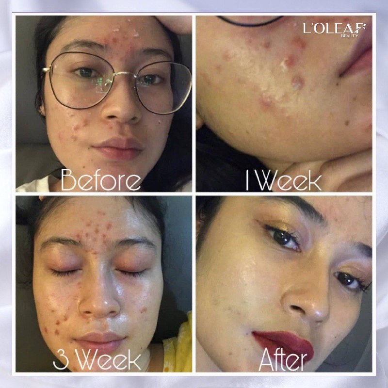 L'oleaf Crystal Tomato Serum